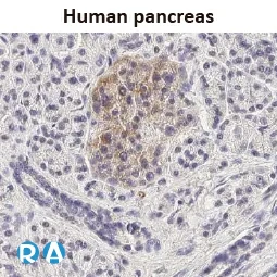 GLP1R antibody [HL2297]
